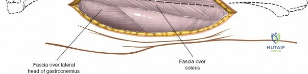 Clinical Image
