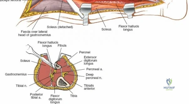 Clinical Image