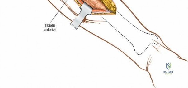 Clinical Image