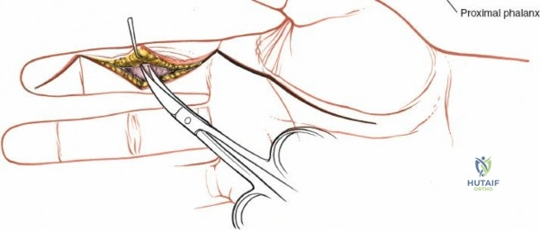 Clinical Image