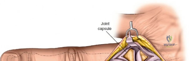 Clinical Image