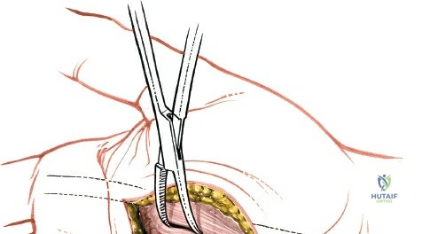 Clinical Image