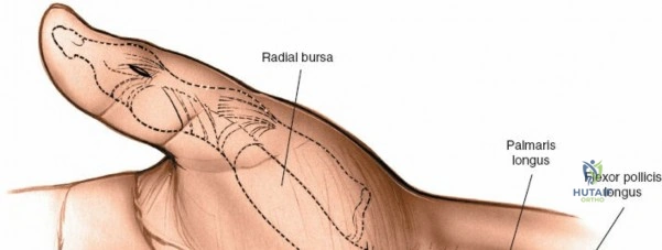 Clinical Image