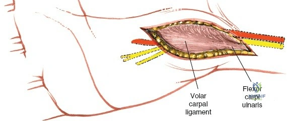 Clinical Image