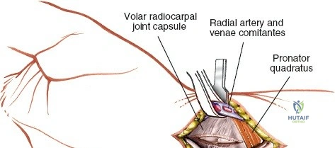 Clinical Image
