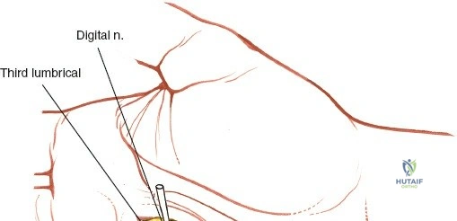 Clinical Image