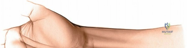 Clinical Image