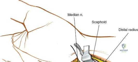 Clinical Image