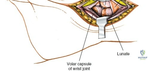 Clinical Image