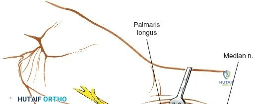 Clinical Image