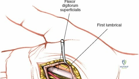 Clinical Image
