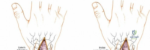 Clinical Image