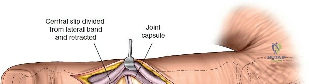 Clinical Image