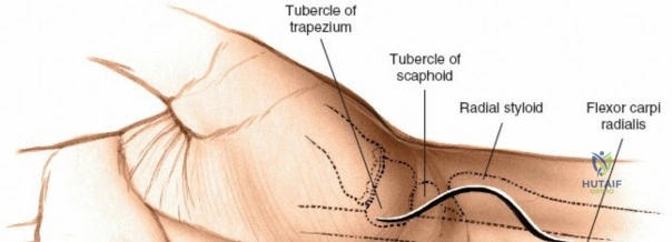 Clinical Image