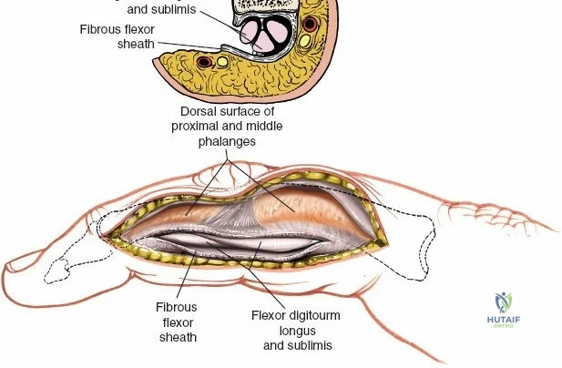Clinical Image