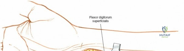 Clinical Image