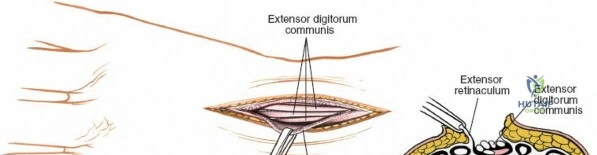 Clinical Image