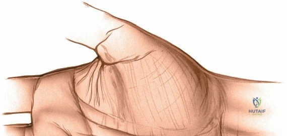 Clinical Image