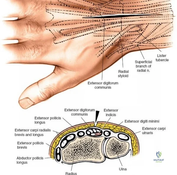 Clinical Image