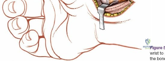 Clinical Image
