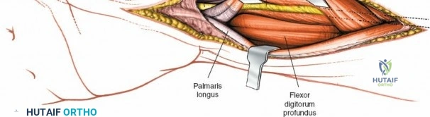 Clinical Image