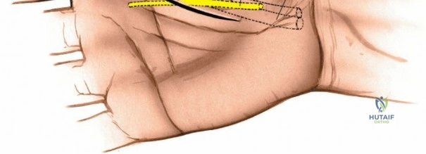 Clinical Image