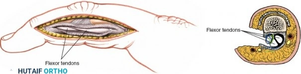 Clinical Image
