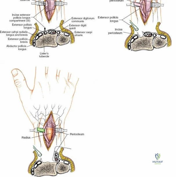Clinical Image