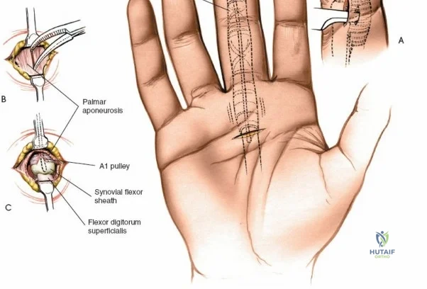 Clinical Image