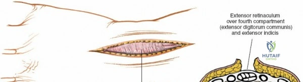 Clinical Image