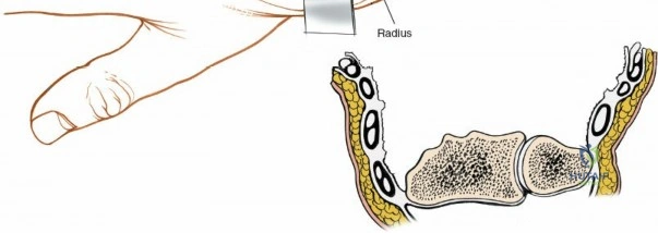 Clinical Image