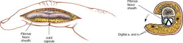 Clinical Image