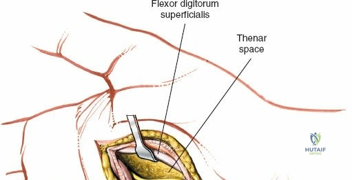 Clinical Image