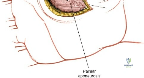 Clinical Image