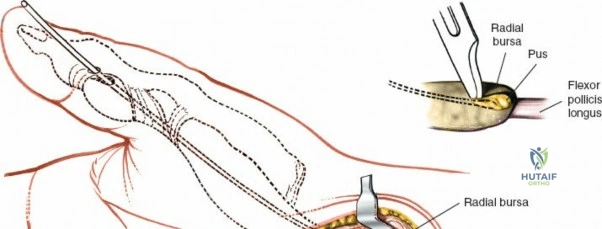 Clinical Image