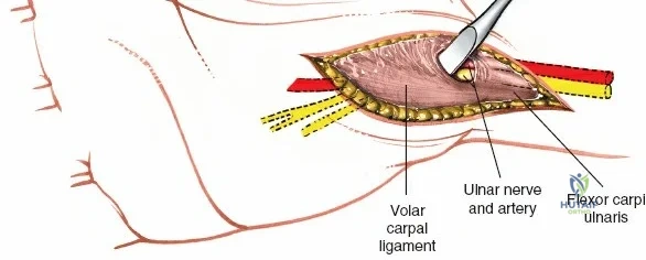 Clinical Image