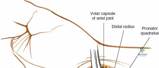 Clinical Image