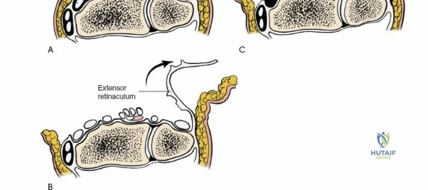 Clinical Image