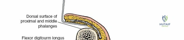 Clinical Image
