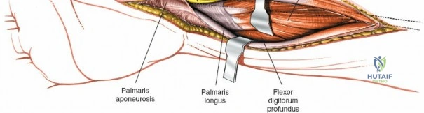 Clinical Image