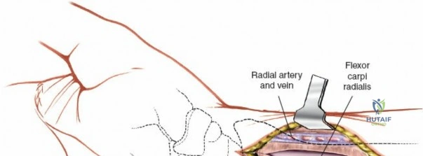 Clinical Image