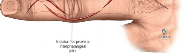 Clinical Image