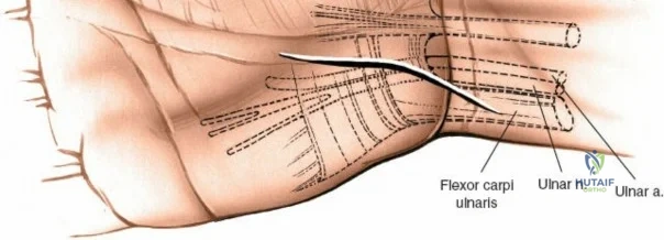 Clinical Image