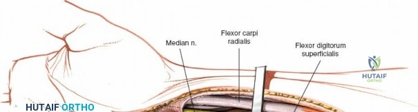 Clinical Image
