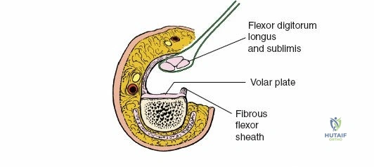 Clinical Image