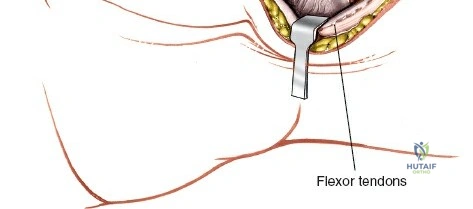 Clinical Image