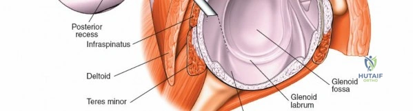 Clinical Image