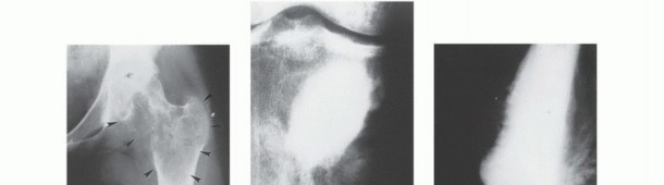 Clinical Image