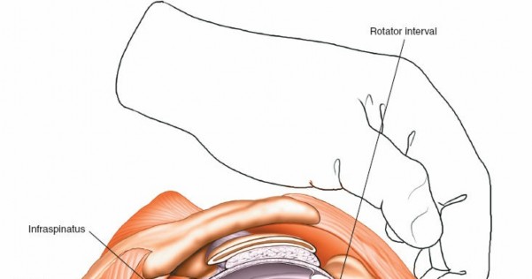 Illustration 219 for Essential Guide: Mastering Every Approach to the Shoulder
