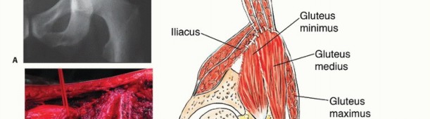 توضيح طبي: جراحة نقائل الحوض: حل شامل لآلام العظام واستعادة الحركة مع الأستاذ الدكتور محمد هطيف